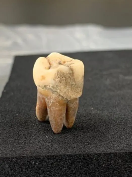 Ancient Dental Calculus