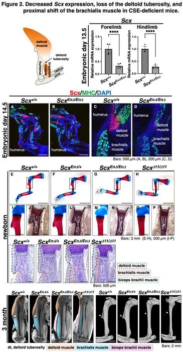 Decreased Scx expression, loss of the deltoid tuberosity, and proximal shift of the brachialis muscle in CSE-deficient mice