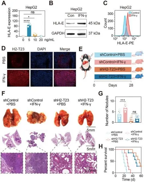 IFN-γ promotes HCC metastasis via HLA-E/H2-T23 induction.
