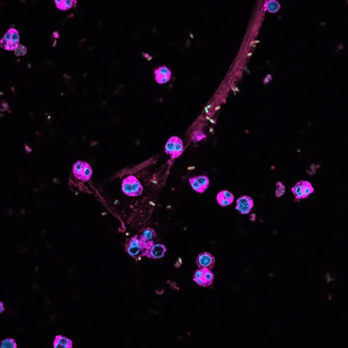 Immune cells (pink) cast out web-like nets (red) that trap bacteria (green).