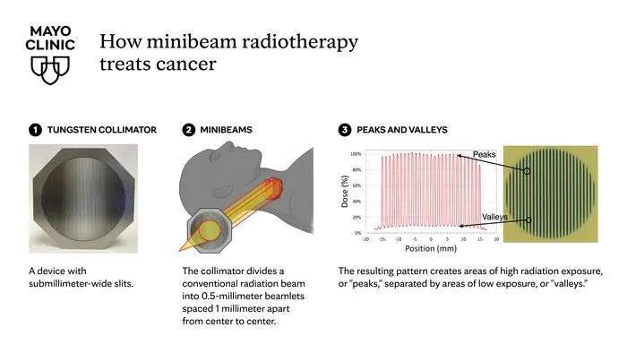 How minibeam radiotherapy treats cancer