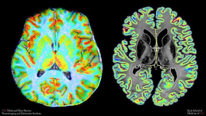 color map of brain blood flow