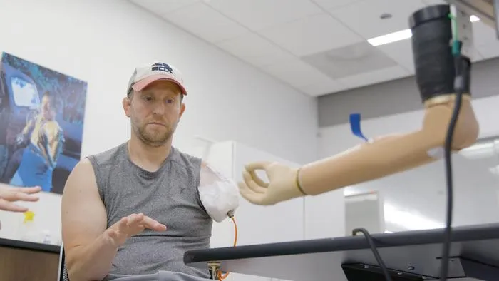 First U.S. Patient Reaches Major Milestone Toward a Bionic Arm Anchored to Bone, Nerves and Muscles