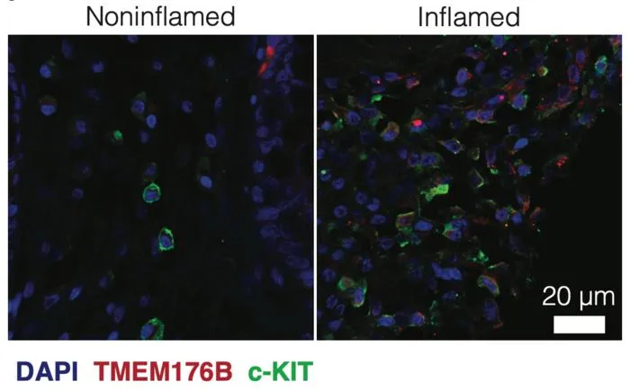 Microscopy images comparing 'quiet' gut tissue (left) and inflamed tissue (right) with labels