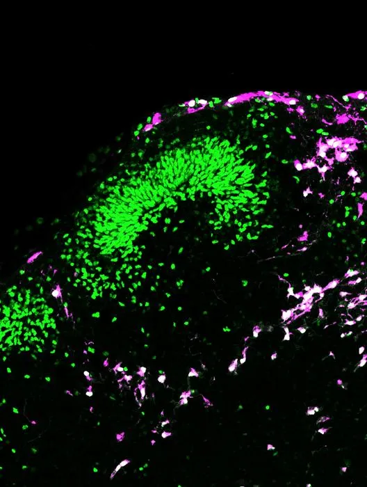 Progenitor cells in brain cortical organoid