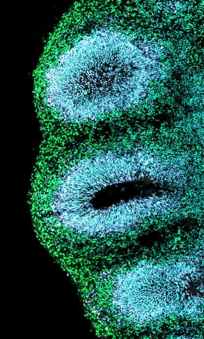 Human brain organoid