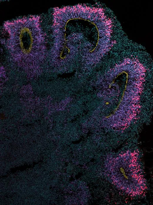 Common marmoset brain organoid