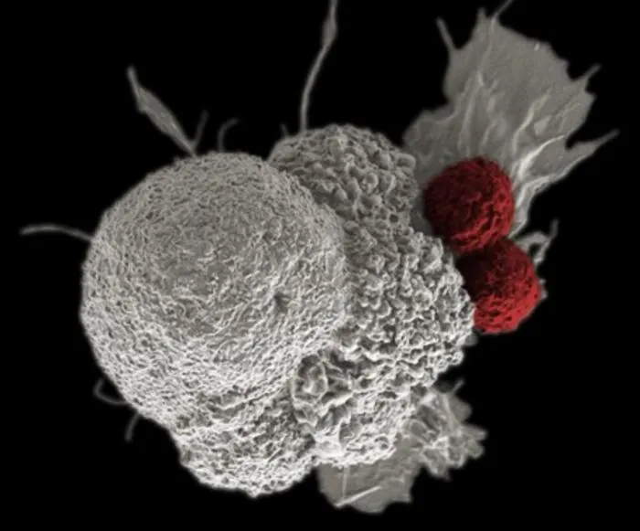 From ex vivo manufacturing to in vivo CAR-T therapy