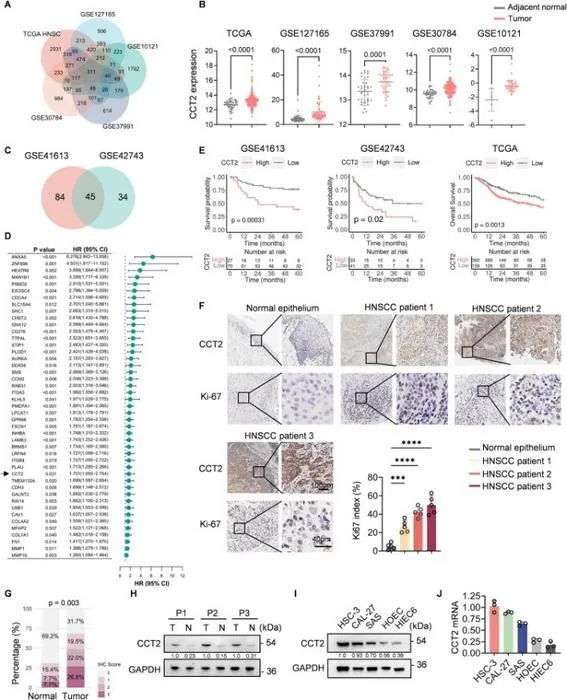CCT2 was highly expressed in HNSCC and related to poor prognosis