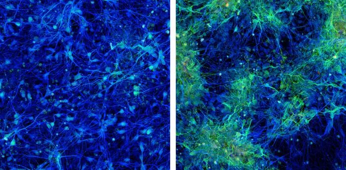 Neuron architecture comparison