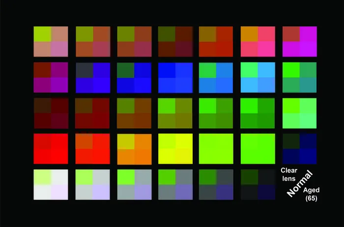 Simulated color differences for different lens pigmentation