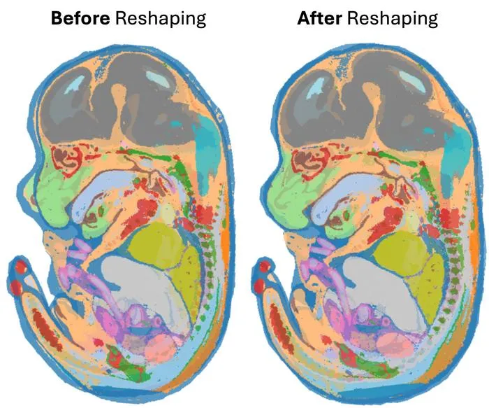Aligning maps of the developing mouse embryo