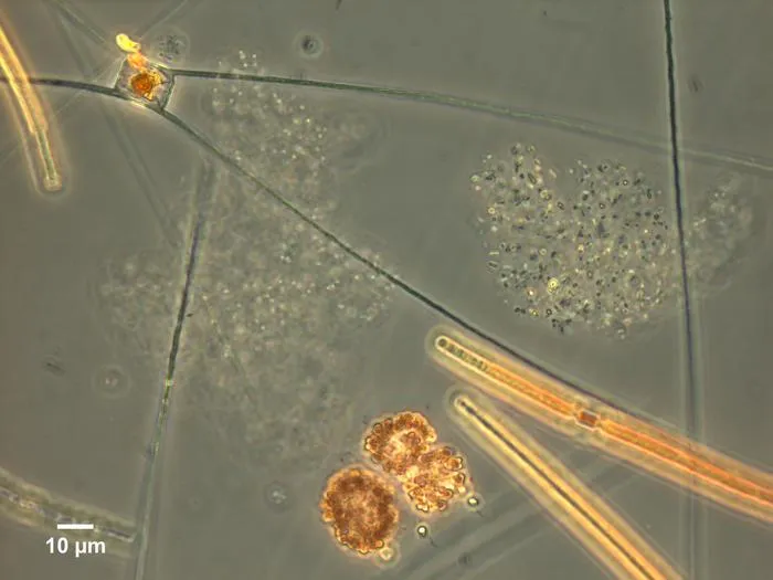 Cyanobacteria and diatom