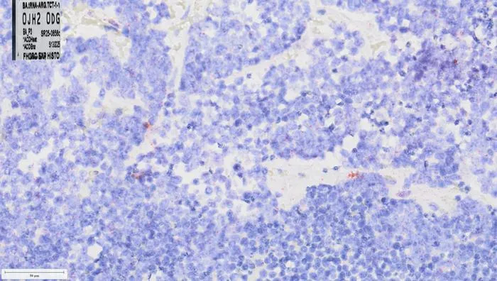 Low tRNA