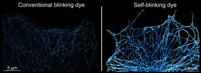 super-resolution imaging comparing conventional blinking dye with self-blinking dye
