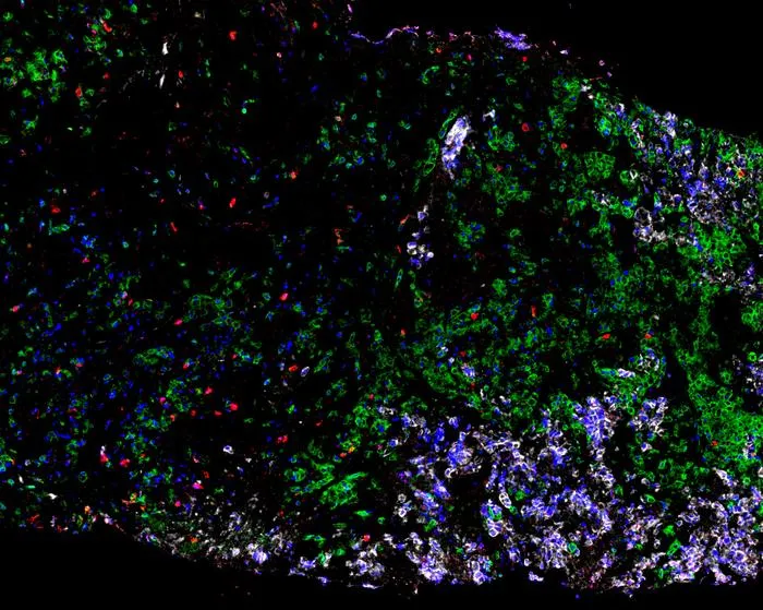 Gamma Lung_Tissue Sample