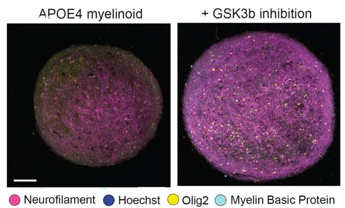 Improved axon growth