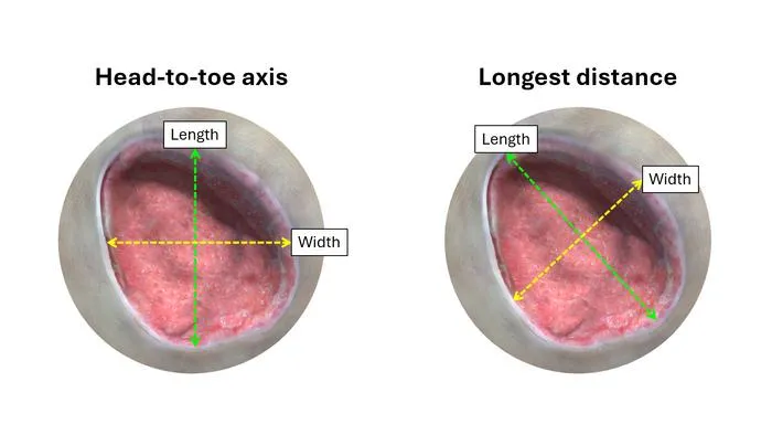 Wound measurements comparison