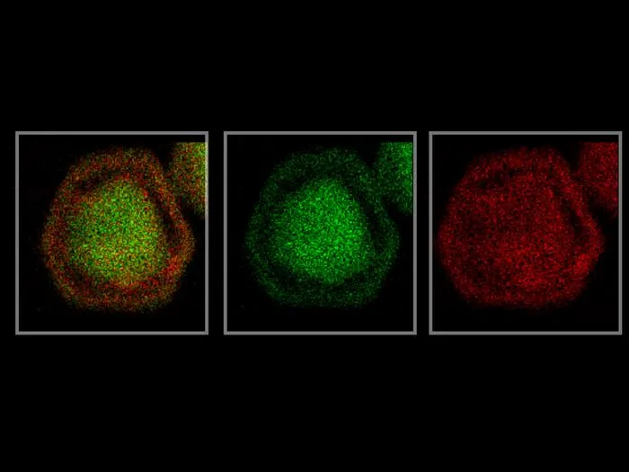 TEM imaging of gold-silver-gold nanoparticle