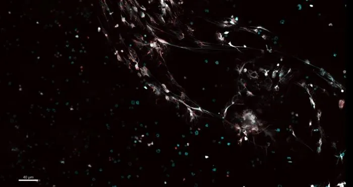 Web-like structures produced by neutrophils