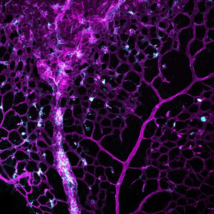 Malformed retinal blood vessels