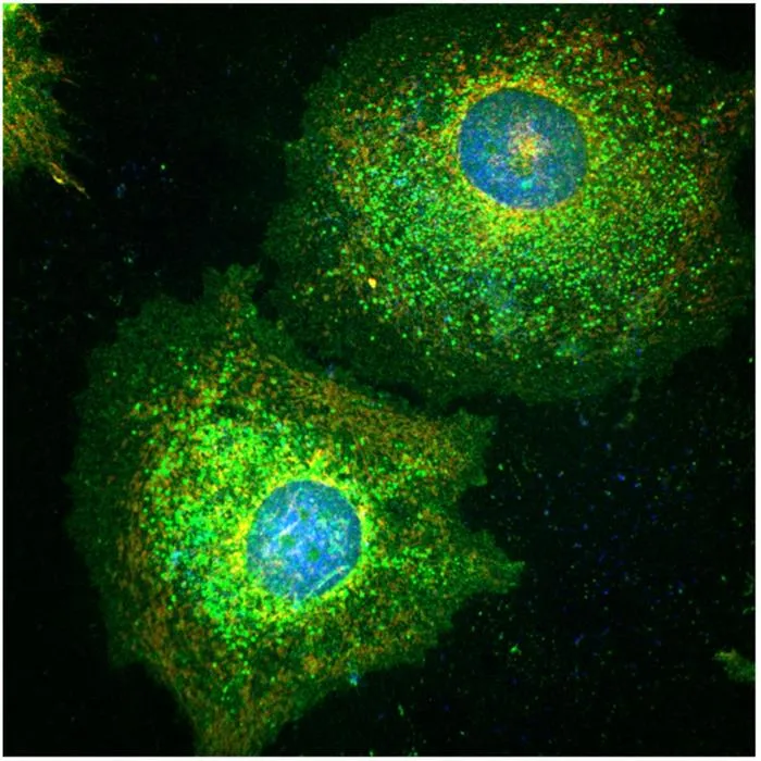 Senescent cancer cells