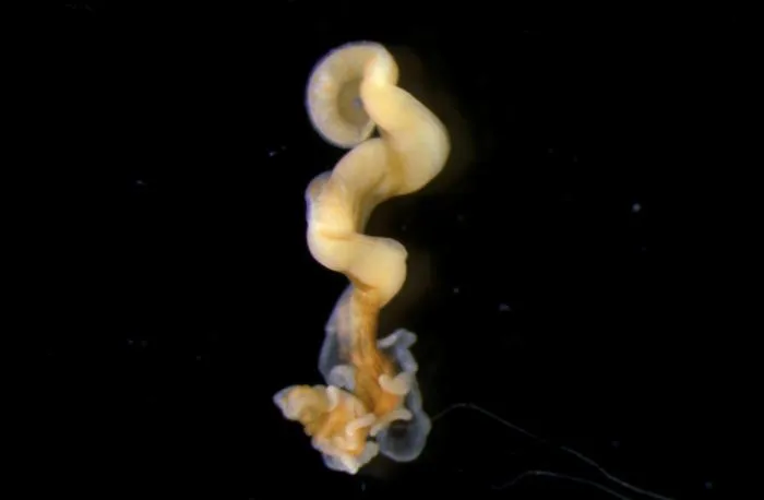 Nematostella up close