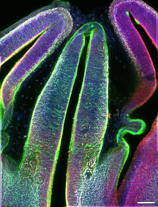 Researchers create the first multi-omic atlas of the developing thalamus