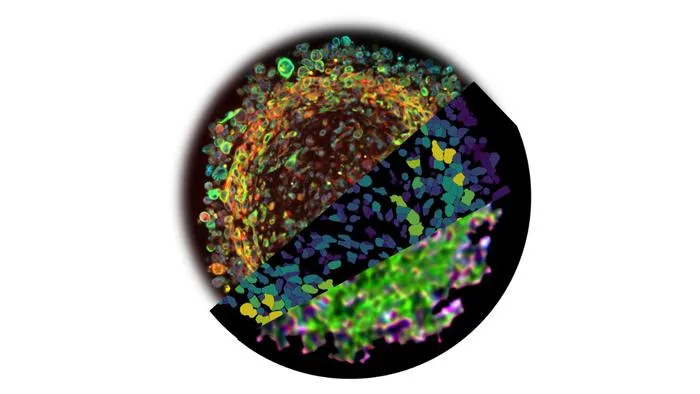 Space-grown Glioblastoma Organoid